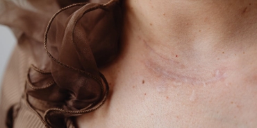 Fred-Neden-Yok-Iste-Sakatlik-Sureci-ve-Sahalara-Donus-Takvimi-featured